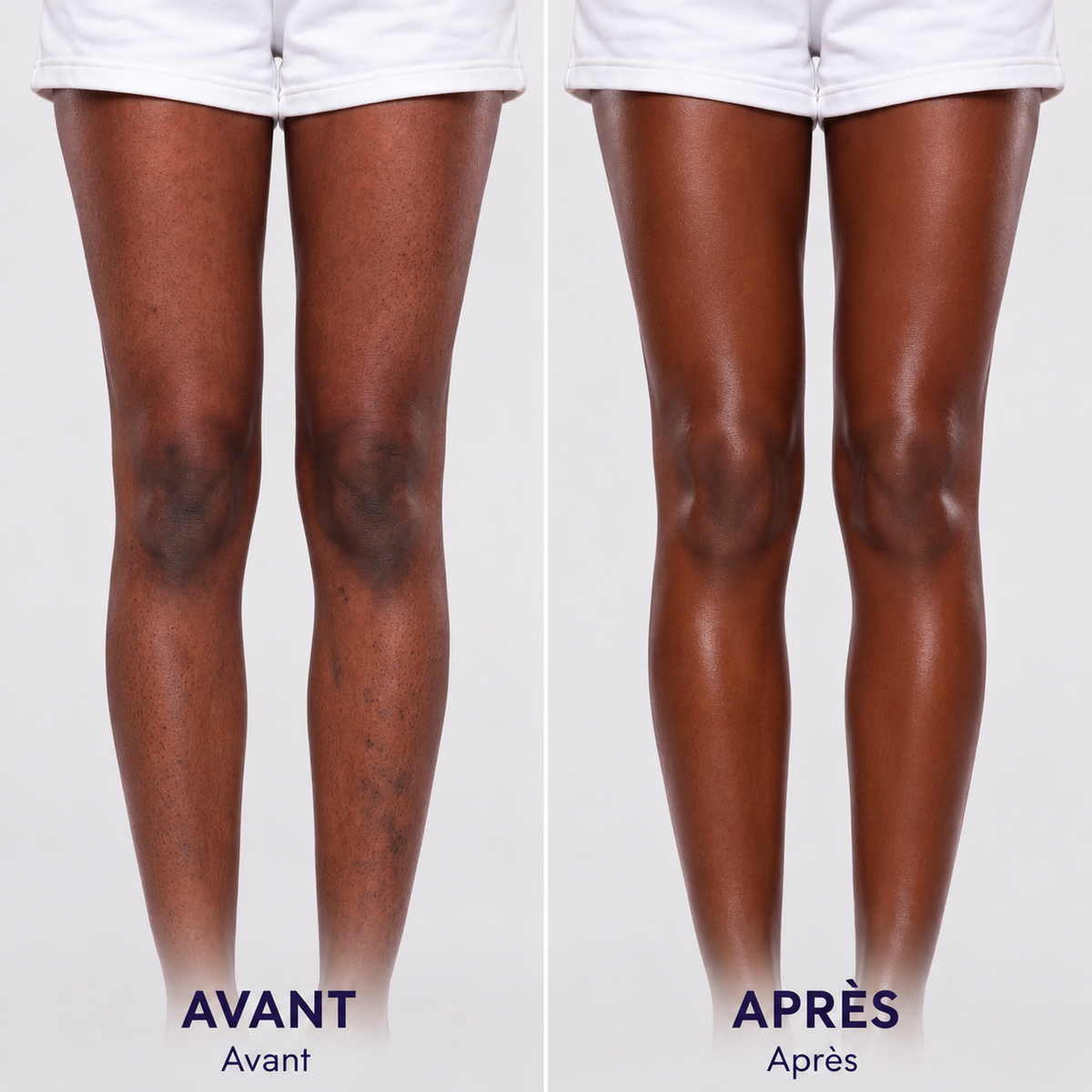 MELUNE™ Perfecteur Corps – Enrichi à l’Huile de Nigelle